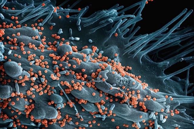 Microbiote intestinal