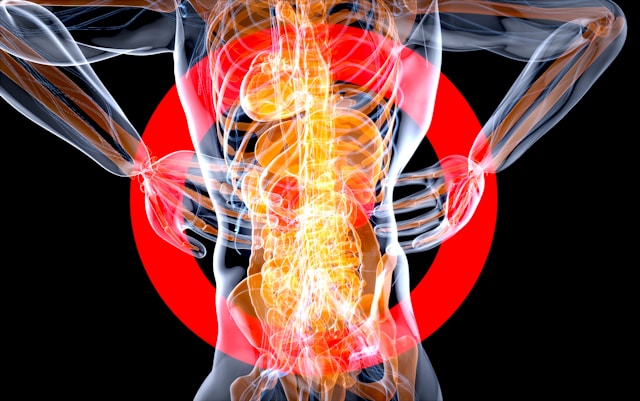 Maladies de l’intestin