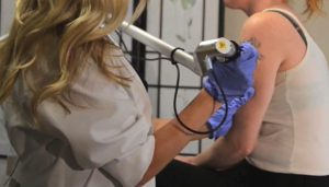 Un professionnel de santé réalise une séance de détatouage laser sur le bras d’une patiente dans un cabinet spécialisé.